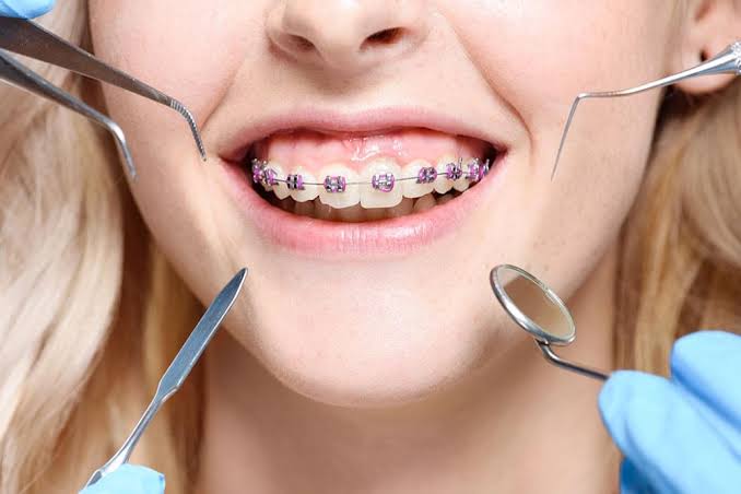 Doctor for Teeth Brace | Sapphire Dental Orthodontic And Implant Centre | 113/16, Kumbha Marg, Near Community Centre, Kumbha Marg, Sanganer, Sector 11, Pratap Nagar, Jaipur, Rajasthan 302033, India
