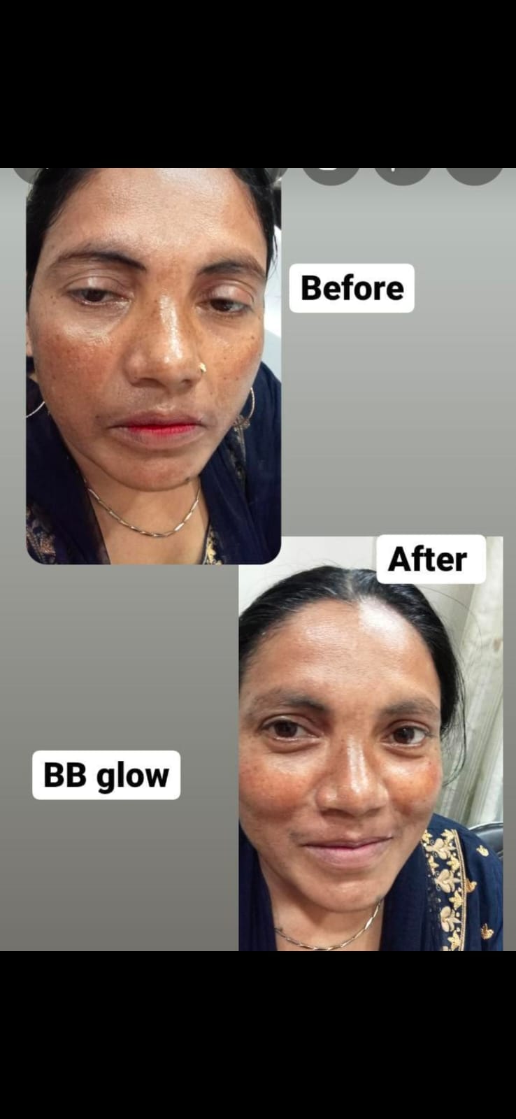 BB Glow treatment The Beauty Maker 27 C Seva Sardar Nager Near Sawariya Park Geeta Bhawan Indore