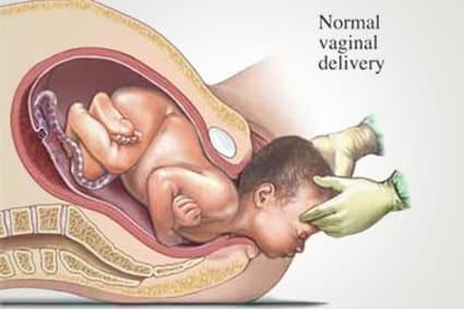Normal Delivery | Jangjeet Hospital Dholpur | Kotla ,Dholpur, Rajasthan