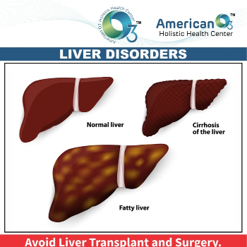 Liver Disorder Treatment | AMERICAN O3 HOLISTIC HEALTH CENTER | S - 8/9 SHREEJI SANKALP NR BACHPAN SCHOOL, 100 Feet Rd, Nanikhodiyar, Anand, Gujarat 388001, India