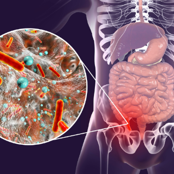 Appendix Operation | JEET HOSPITAL | Kotla ,Dholpur, Rajasthan