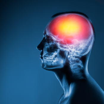 Brain Tumor Surgery in Shivajinagar, Pune | Brain And Spine Surgeon | Joshi Hospital , Maharashtra Medical Foundation , 778, Kamala Nehru Park Road , Opposite Kamala Nehru Park , Shivajinagar