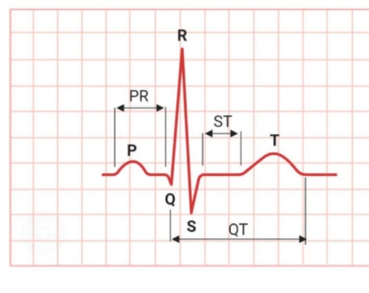 ECG | RD Diagnostic Center & Wellness Clinic | 20, Kailashpuri ,Opp.Khandaka Hospital ,Tonk Road Jaipur