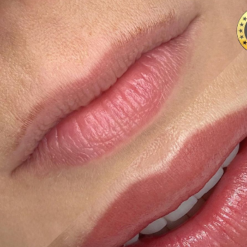 Lip Blushing | Shree Lahri Poly Clinic Gondia | Avanti Chawk, Angur Bagija Rd, Near Nilesh Medical Stores, Gondia 441614