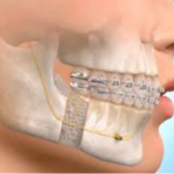 Oral Maxillo Doctor | Shubham Dental Clinic | Maharana Pratap Circle, 171/06, Haldighati Marg, Opp. Mewar Apparment, Sector 17, Pratap Nagar, Jaipur, Rajasthan 302033, India