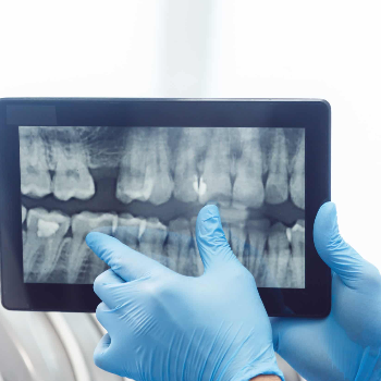 Dental X-rays - Best Dental Clinic in Wakad Pune | Cdic Smiles Dental Clinic, Wakad | Wakad Pune, Maharashtra 411047, India