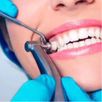 Teeth cleaning | Sai Dental And Implant Center | Anurag, Plot No.7, Near, Cummins College Rd, Anand Colony, Suvarn Colony, Hingne Budrukh, Karve Nagar