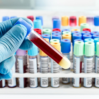 Lab Collection Facility | Kalrav Children Hospital | Dabhoi - Waghodia Ring Road, A-1, Brahmpuri, Soc, Batuji Nagar, Waghodia, Vadodara, Gujarat 390019, India