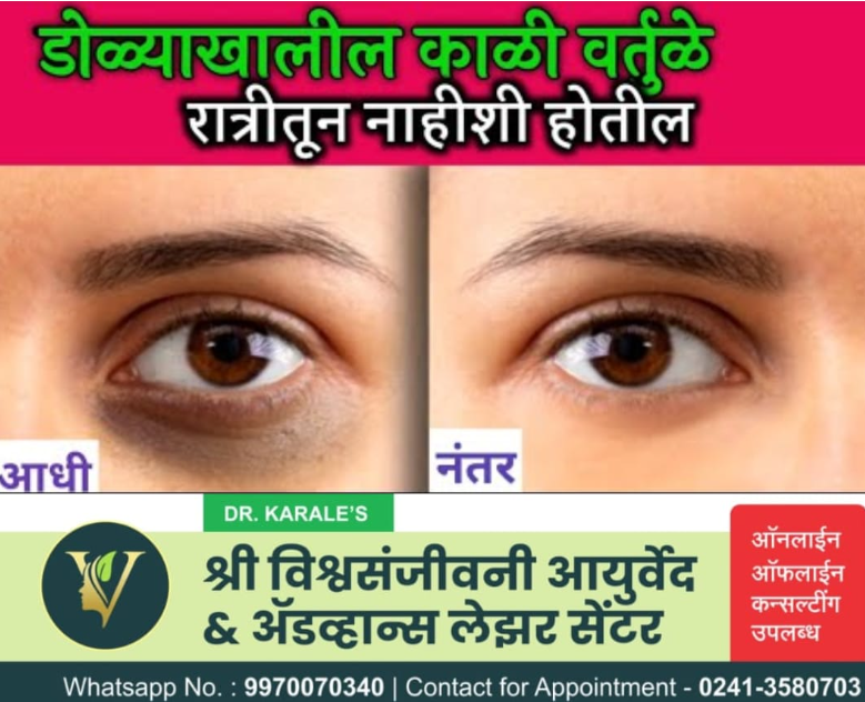 डोळ्याखालची काळी वर्तुळे घालवणे- Dark Circle Treatment | Shri Vishwasanjeevani Ayurved And Advance Laser Center | Flat No 204, Aaradhya Avenue, Pipeline Rd, Near Ekvira Chowk, Savedi, Ahmednagar, Maharashtra 414003, India