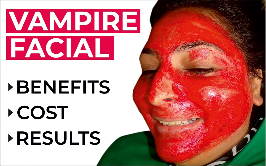 Vampire Facial Treatment | Shri Vishwasanjeevani Ayurved And Advance Laser Center | Flat No 204, Aaradhya Avenue, Pipeline Rd, Near Ekvira Chowk, Savedi, Ahmednagar, Maharashtra 414003, India