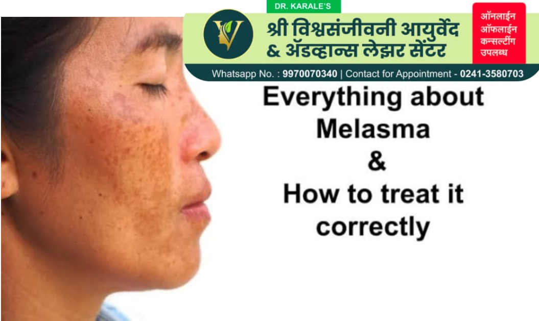 वांग व मुरुम / पिपल्स उपचार -  Melasma &amp; Pimples Treatment | Shri Vishwasanjeevani Ayurved And Advance Laser Center | Flat No 204, Aaradhya Avenue, Pipeline Rd, Near Ekvira Chowk, Savedi, Ahmednagar, Maharashtra 414003, India