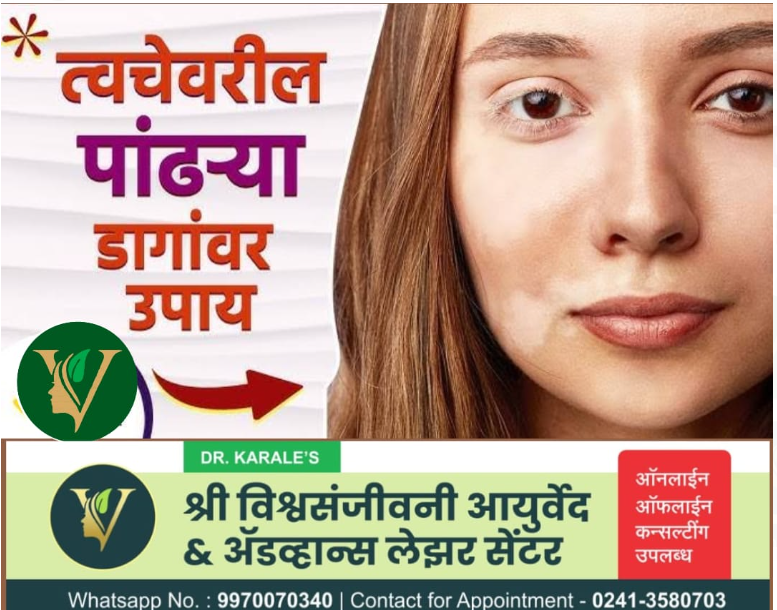 पांढरेाग / कोड - Vitillgo Treatment | Shri Vishwasanjeevani Ayurved And Advance Laser Center | Flat No 204, Aaradhya Avenue, Pipeline Rd, Near Ekvira Chowk, Savedi, Ahmednagar, Maharashtra 414003, India