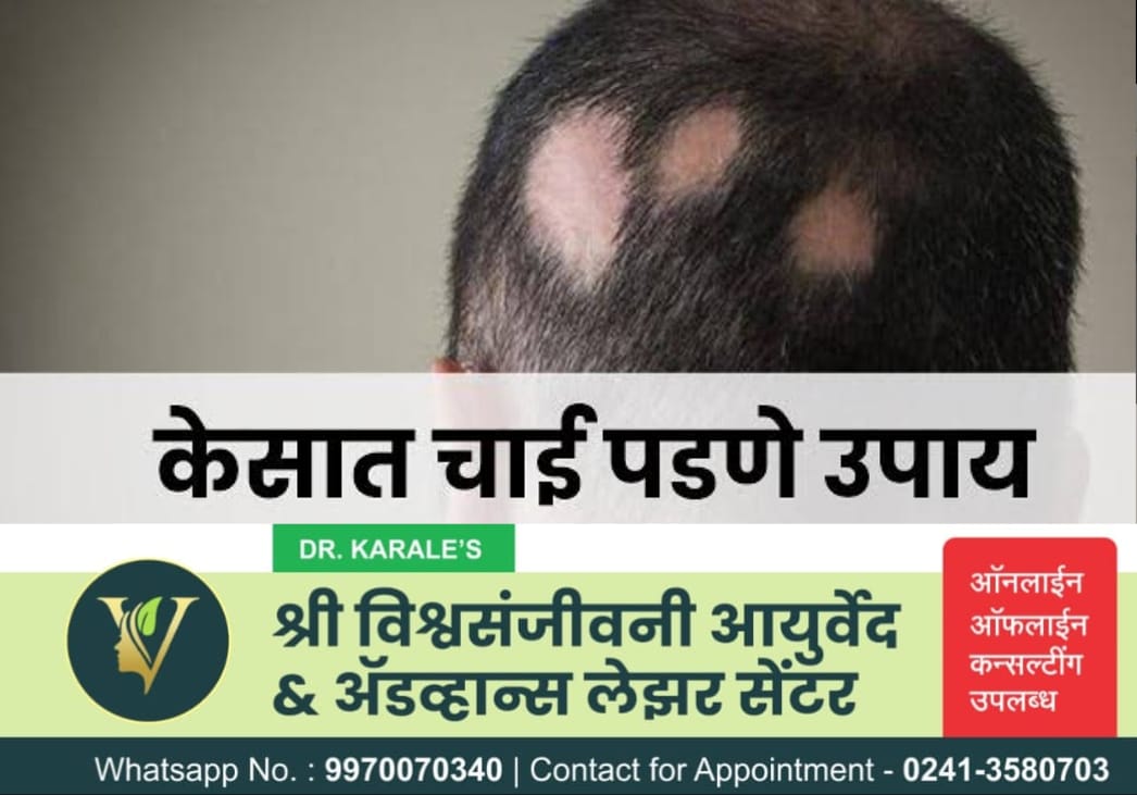चाई लागणे / टकल - Alopecia Treatment | Shri Vishwasanjeevani Ayurved And Advance Laser Center | Flat No 204, Aaradhya Avenue, Pipeline Rd, Near Ekvira Chowk, Savedi, Ahmednagar, Maharashtra 414003, India