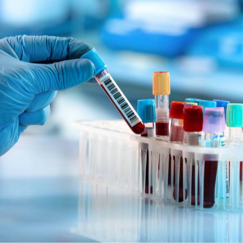 Blood Test | Poona Diagnostic Centre | Shop No B1/2, Samarth Swaroop Soc, Near Bhairavnath Mandir, Ambegaon Budruk, Pune, Maharashtra 411046, India