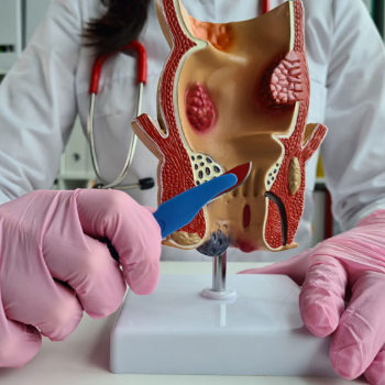 Piles Ayurvedic treatment | Patidar Piles Clinic | Lotus Hospital, Varruchi Marg, Near 69, Freeganj, Madhav Nagar, Ujjain, Madhya Pradesh 456010, India