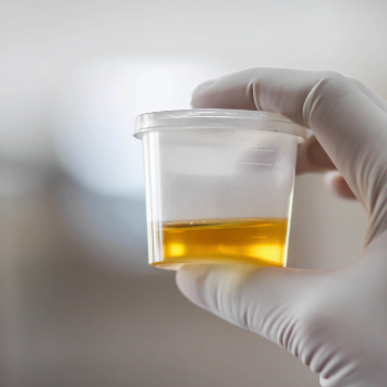 Urine Test | Welcome To Poona Diagnostic Centre | Shop No 1, Datta Chhaya Building, Dhahanukar Chowk, Karve Rd, Next To Shabri Hotel, Happy Colony, Kothrud, Pune, Maharashtra 411029