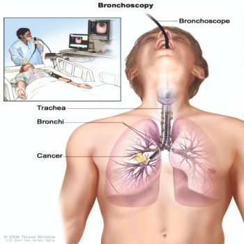 Broncoscopy | Prime Hospital | 347/7,  Opposite Gangapuri Road, Sanoli Road, Panipat, Haryana, 132103