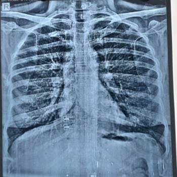 X-Ray | Prime Hospital | 347/7,  Opposite Gangapuri Road, Sanoli Road, Panipat, Haryana, 132103