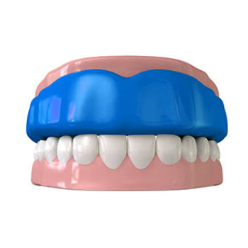 Sports Dentistry | Shree Dental- Dr. Vittal Nagrgoje | Pimpri-Chinchwad, Maharashtra 411027, India