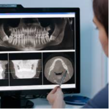 Dental X-ray Care 32 Dental Clinic And Implant Center Adarsh Complex, Sahakari Jin Rd, Nautan Vihar Society,  Gadhoda, Gujarat 383001, India