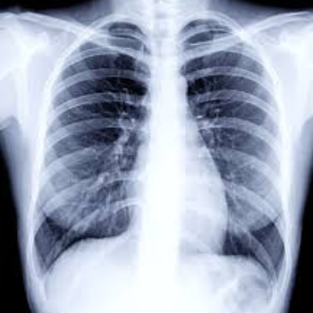 X-Ray | Radhakrishna Hospital | Mumbai - Agra Rd, Near IDBI Bank, Pimpalgaon Baswant, Maharashtra 422209, India