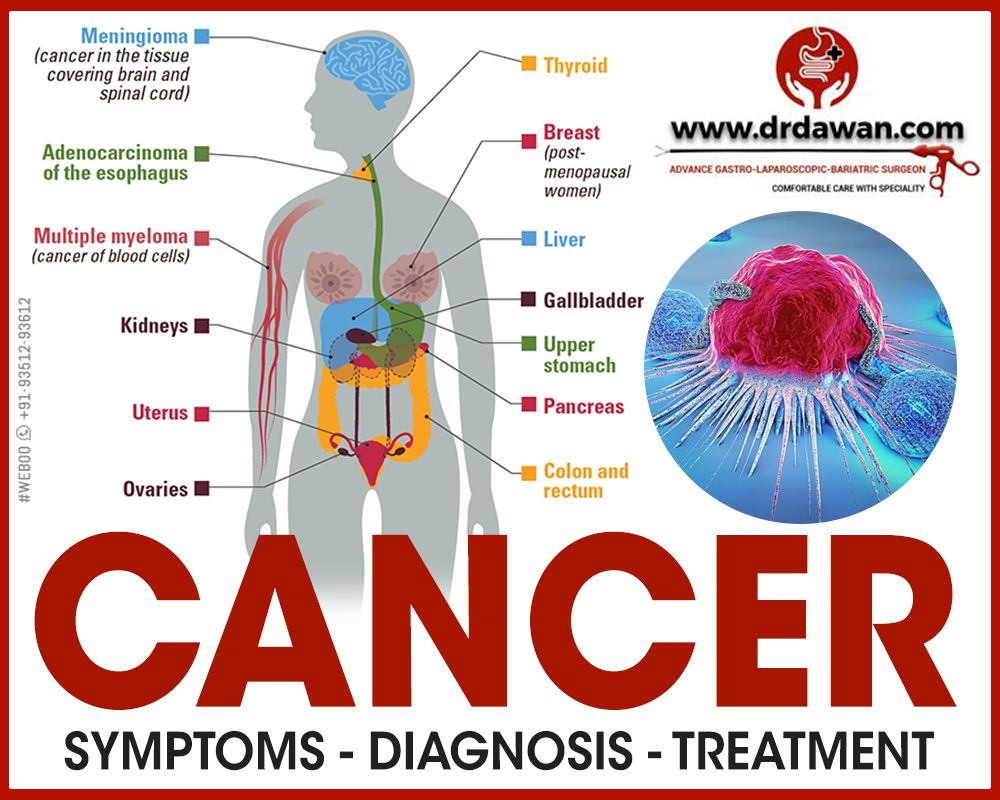 Cancer Diagnosis And Treatment | Radhakrishna Hospital | Mumbai - Agra Rd, Near IDBI Bank, Pimpalgaon Baswant, Maharashtra 422209, India