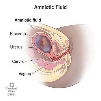 Disorders Of The Amniotic Sac | Radhakrishna Hospital | Mumbai - Agra Rd, Near IDBI Bank, Pimpalgaon Baswant, Maharashtra 422209, India