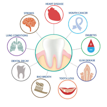 Preventive Dentistry | ASHWIN DENTAL CLINIC | King's Square Building, J-11, New DP Rd, Near Medipoint Hospital In Between Bank Of Baroda & Indian Bank, Aundh, Pune, 411007