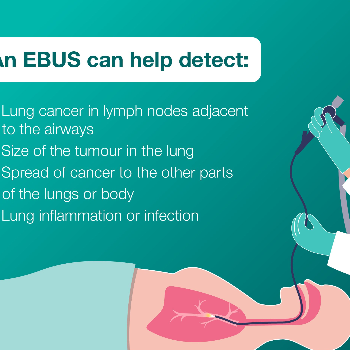 Endobronchial Ultrasound | Chest Clinic, Pune | 5th Floor, Nandan Pride, A Wing, Karve Putala Chowk, Mayur Colony, Kothrud, Pune, Maharashtra 411038, India