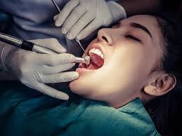 Root canal | BRACES And Faces | 38 Brajeshwari Annex Near Ados Pados Apartment Bangali Squre Indore