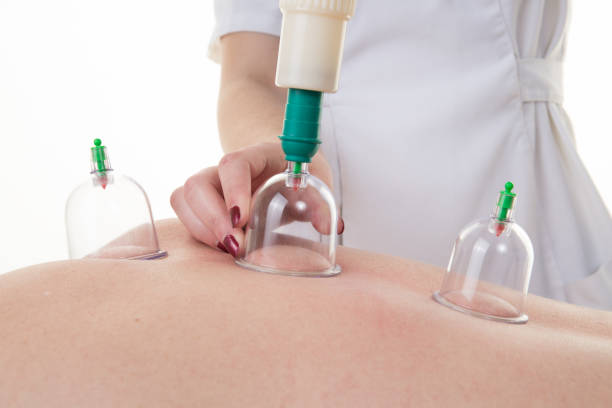 Dry Or Wet Cupping Therapy | REVIVE PHYSIOTHERAPY CLINIC | Pipli