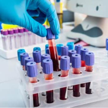 Antibody Test Pune | Golwilkar Metropolis | No 796/189 B, Gr Flr, Construction House, Bhandarkar Road, Pune, 411004