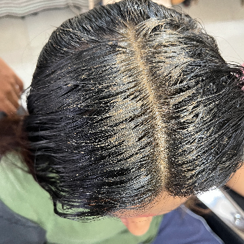 Hair fall and Dandruff treatment Glow Face Beauty Salon And Training Center Shop No 01,Ground Floor,Anand Nivas,Warje Canal Road,Pune