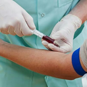 BLOOD TEST