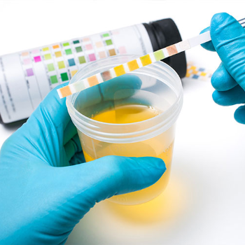URINE AND STOOL TESTS Dr Lal Pathlabs NEAR KRB ENGINEERING KESHAV NAGAR PUNE