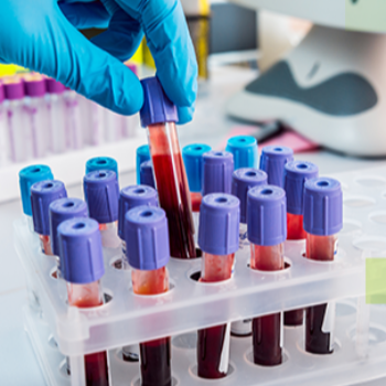 SPECIALIZED TESTS Dr Lal Pathlabs NEAR KRB ENGINEERING KESHAV NAGAR PUNE